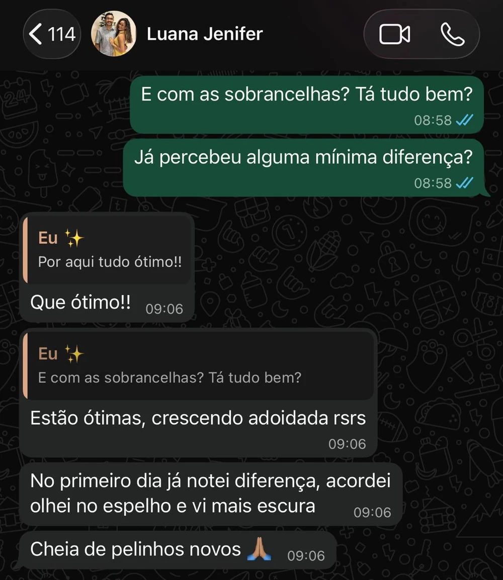 Depoimento de cliente — resultado do protocolo Renascy Brows